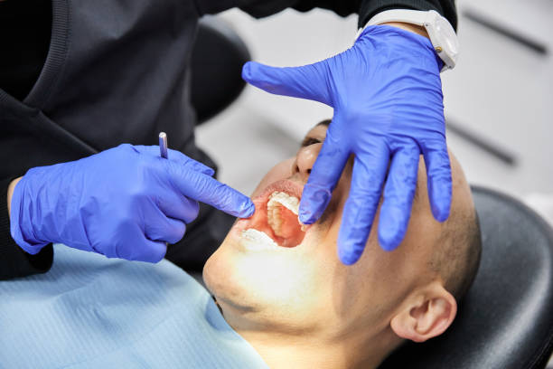 Best Chipped Tooth Repair Near Me  in Ke Charles, LA